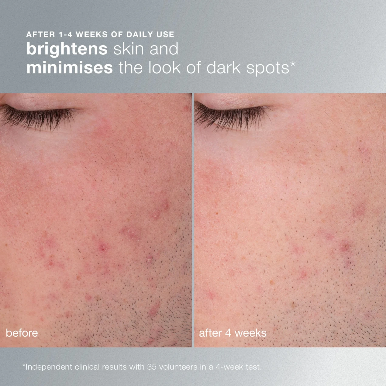 dermalogica-daily-microfoliant-Clinical1