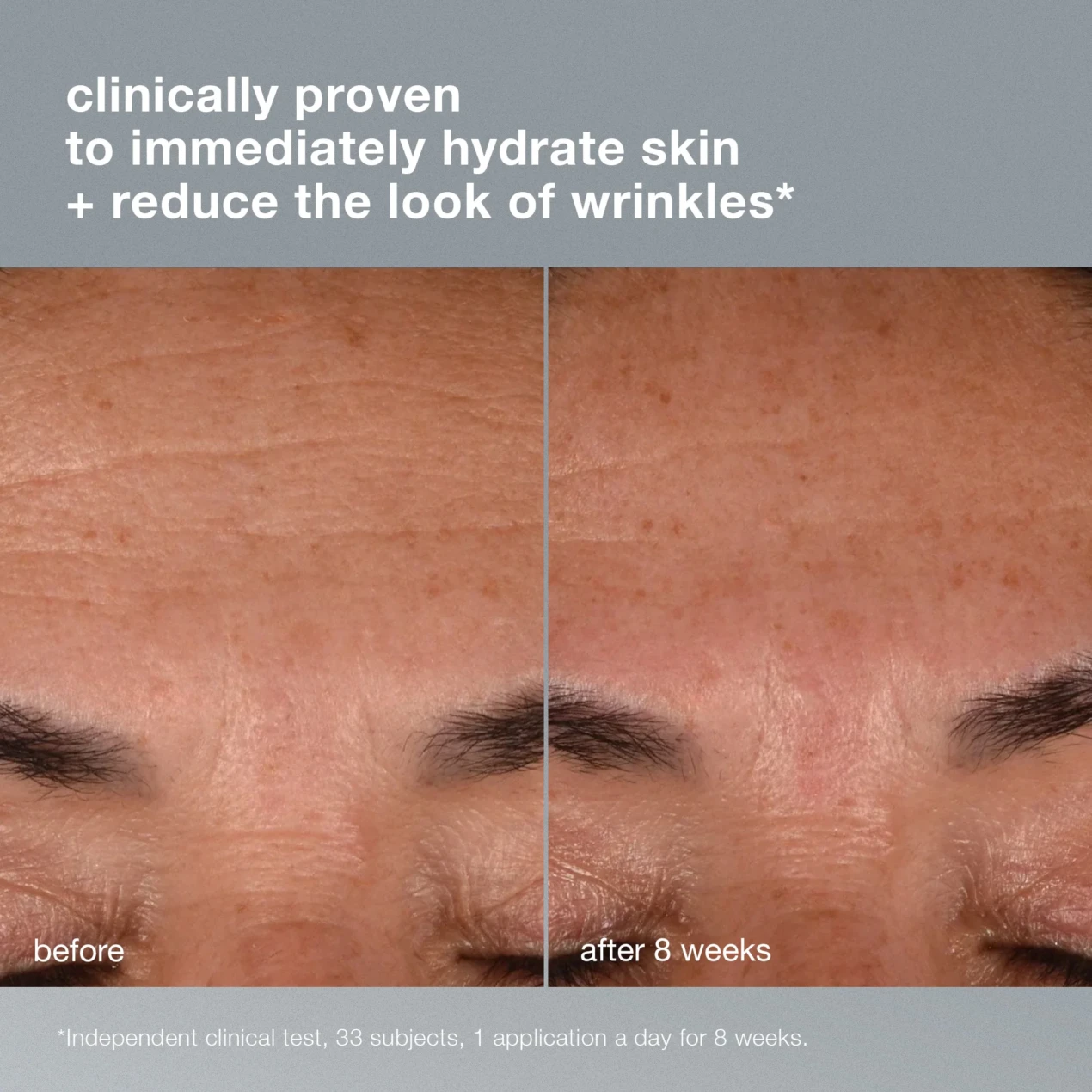 dermalogica-dynamic-skin-recovery-Clinical