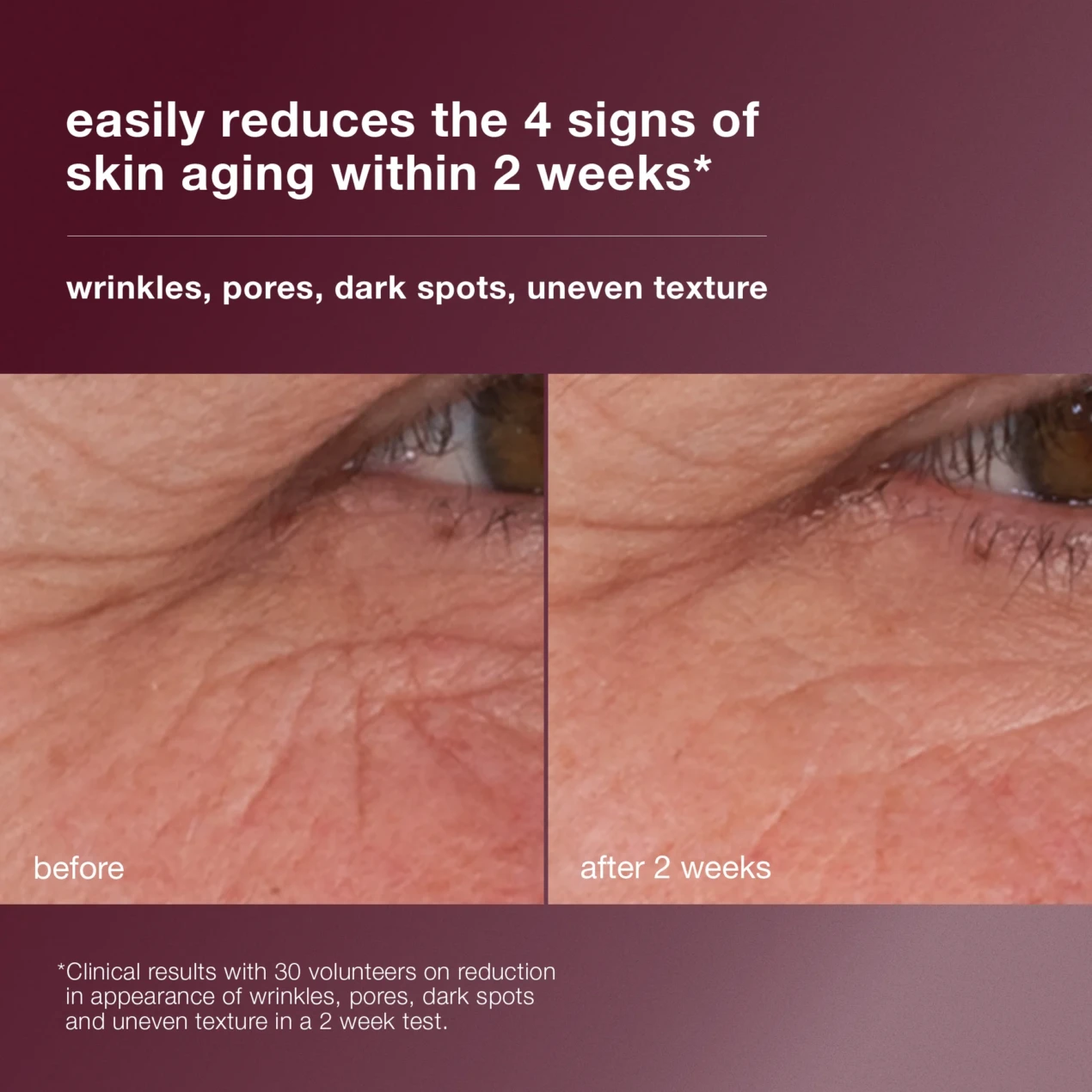 dynamic-skin-retinol-serum-Clinical