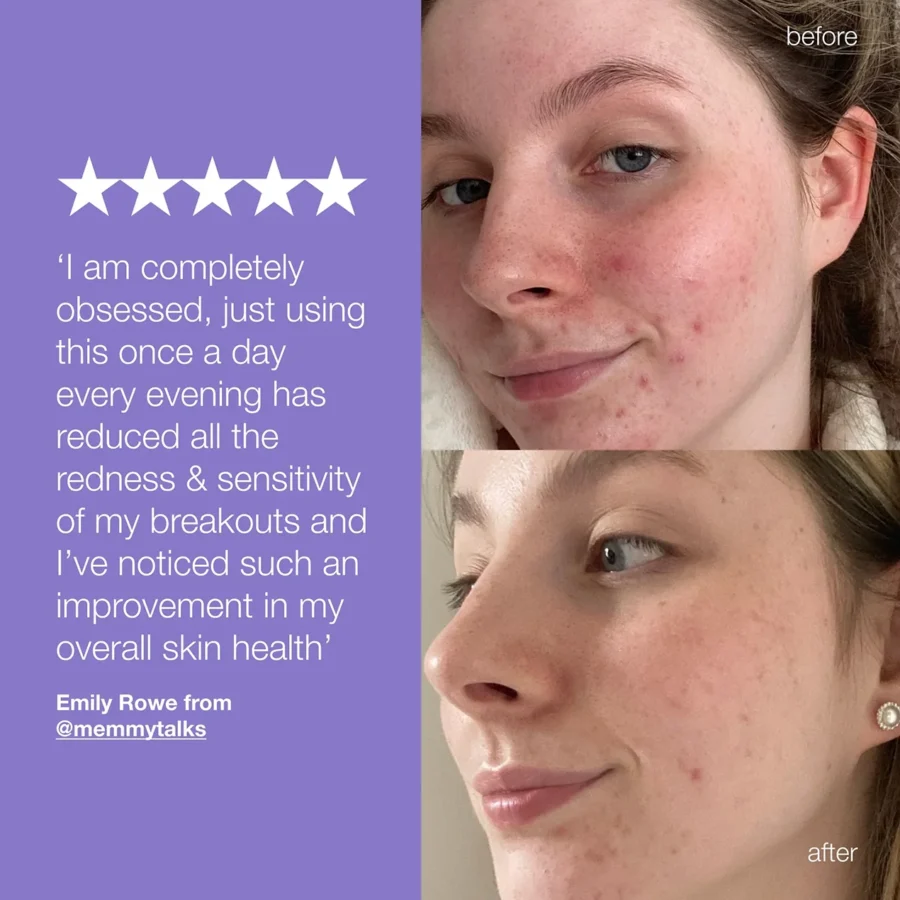 stabilizing repair cream quote